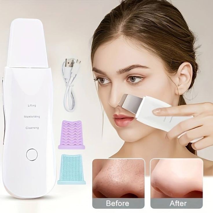 LIMPIADOR FACIAL ULTRASONICO PEELFRESH®️