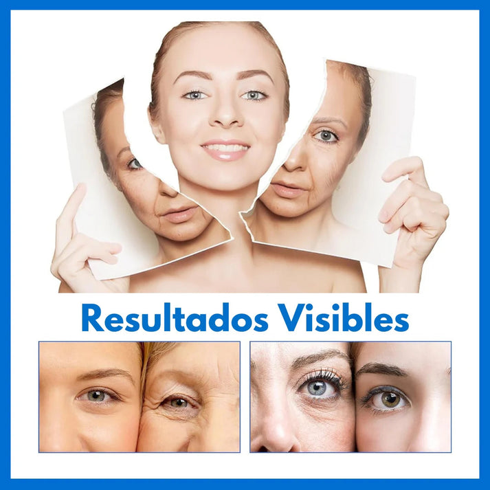 Super Oferta 2X1 BOTOX Stock Solution Serum antiarrugas